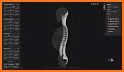 Biomechanics of the Spine Lite related image