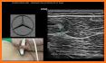 MSK ultrasound Lower Limb related image
