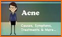 Acne: Causes, Treatment, And Tips related image