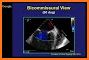 Echocardiography 2e related image