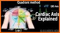 Electrocardiogram (ECG) Rhythm App: Heart Axis related image