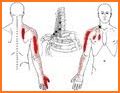 Referred Pain Index related image