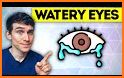 Watery Eyes (Guide) related image