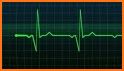 Heartbeat Monitor : Heart Rate, Pulse, Cardiograph related image