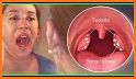 How to Diagnose Tonsillitis related image