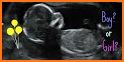 Pregnancy. Child gender test related image