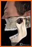 Skull, Teeth & TMJ related image