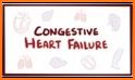 Congestive Heart Failure related image