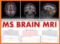 Brain Scan related image
