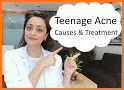 Acne: Causes, Treatment, And Tips related image
