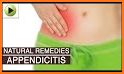 Appendicitis Info related image