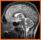 Atlas of MRI Brain Anatomy related image