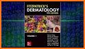 Fitzpatrick's Dermatology, 9th Edition, 2-Vol. Set related image